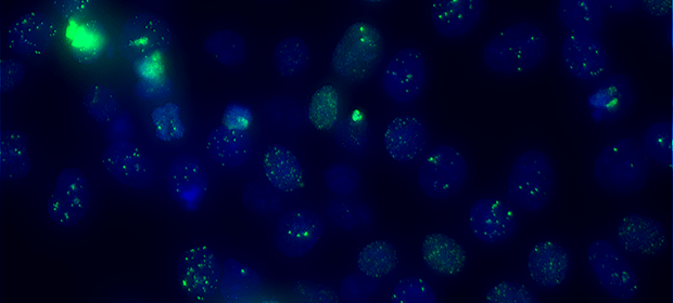 Fig.1: Evaluation of the DNA-damage-response-system with yH2AX-immunofluorescence staining; green foci are indicating ongoing DNA-repair.