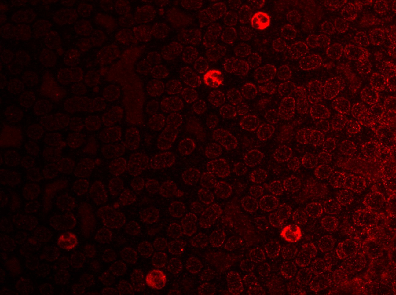 MMP-9-expressierende Zellen unterm Fluoreszenzmikroskop