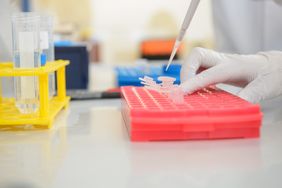 Das Bild zeigt das Pipettieren von Blut im Labor 