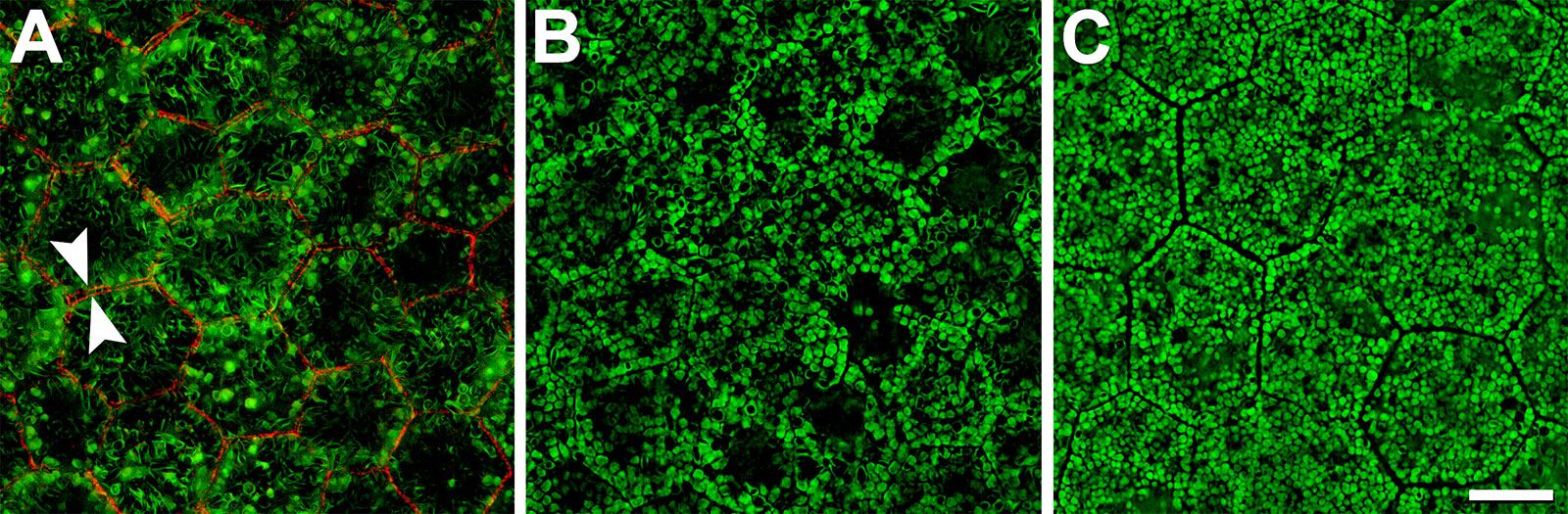 Abbildung einer Autofluoreszenz von RPE-Zellen