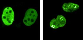 MYC-Proteine sind in dieser Abbildung grün gefärbt.