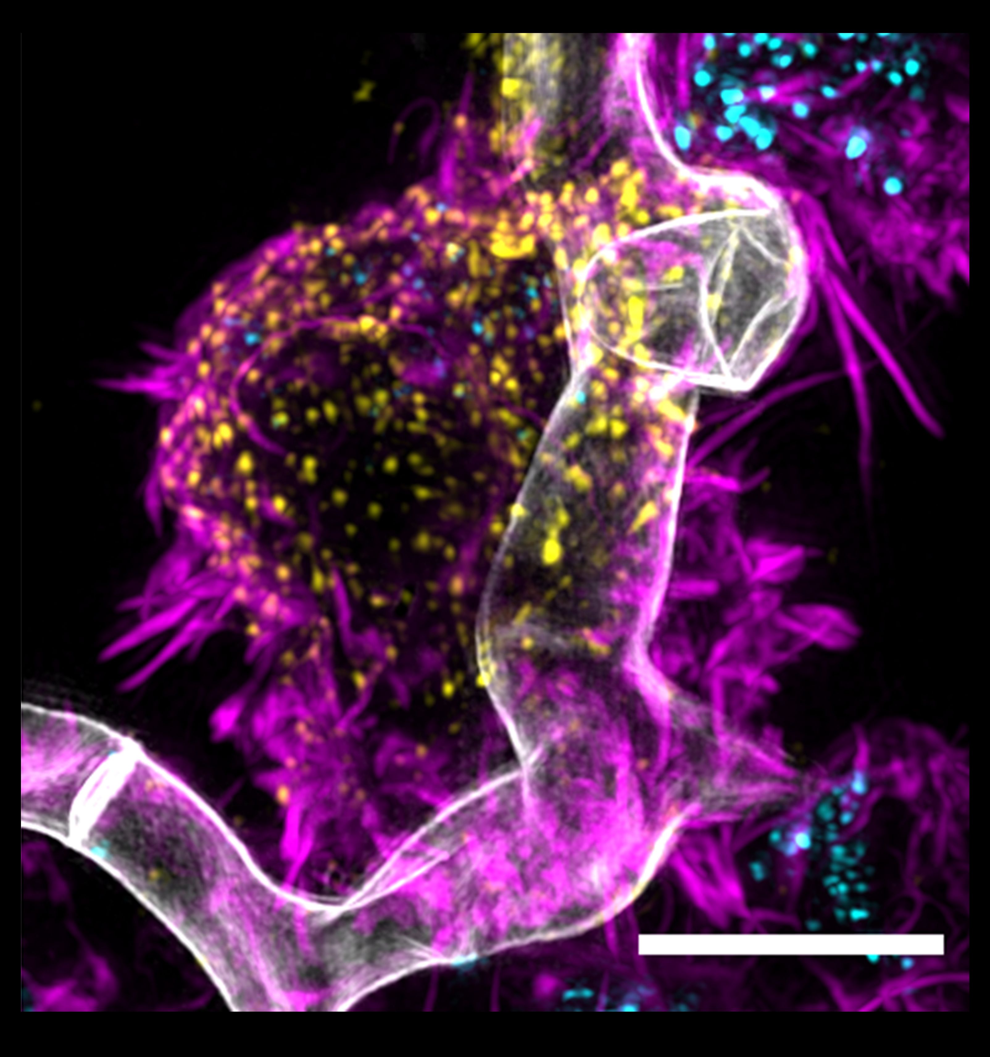 Das Bild zeigt CAR-T-Zellen, Schimmelpilz und körpereigene Botenstoffe in Interaktion. 