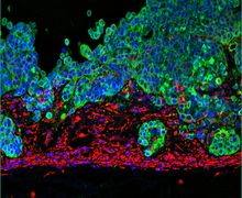 Immunhistochemische Färbung eines 3D Lungen-Tumormodells mit integrierter Umgebung (Stroma) nach dynamischer Kultur im Bioreaktor auf einer biologischen Gewebematrix (SIS). Grün: Krebszellen, Rot: Stroma-Zellen. Blau: Zellkerne.