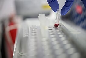 Hier wird eine Blutprobe für den neuen Roboter EZ2 Connect vorbereitet. Der Roboter kann DNA und RNA extrahieren, sowohl aus Blut als auch aus Zellen. 