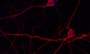 Sensory nerve cells in cell culture