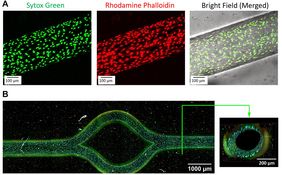 Verschiedene Ansichten eines Blutgefäßes in Durchlicht-Mikroskopie