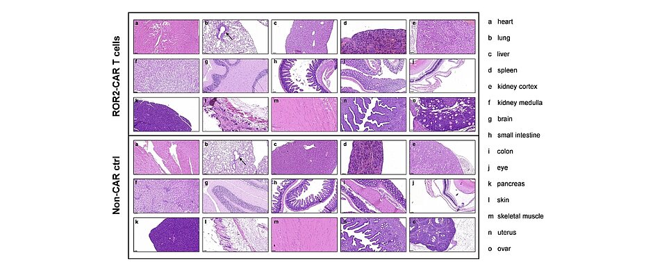 Schnitte und Färbungen von Gewebe aus verschiedenen Bereichen des Körpers