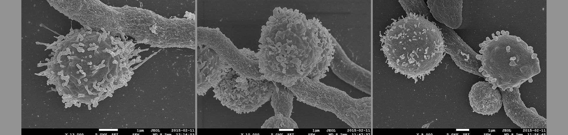Illustrationsbild Mikroskopaufnahme invasiver Pilzinfektionen