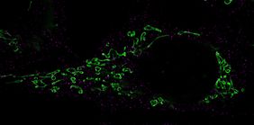 Mikroskopische Aufnahme, die den Zerfall der Mitochondrien zeigt.