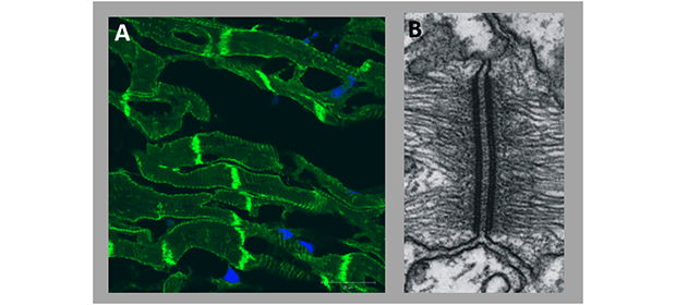 Desmosomes. (A) Immunostaining of cardiac tissue with an anti-plakoglobin antibody indicating intercalated discs with desmosomes. (B) Electronmicrograph of a cardiac desmosome.