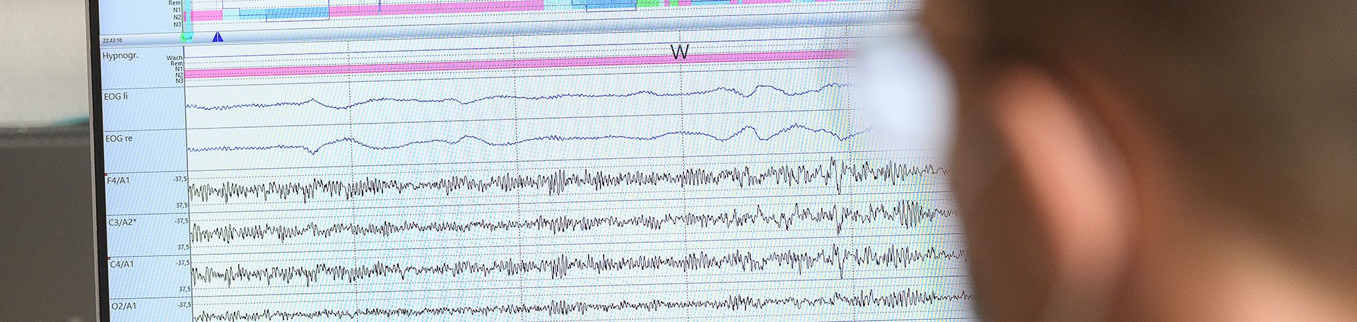 Illustrationsbild Auswertung im Schlaflabor