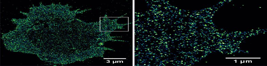 Abbildung über die Verteilung von CD19-Antigenen in der Plasmamembran einer multiplen Myelomzelle aufgenommen mittels dSTORM