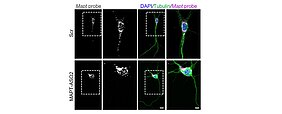 FISH - mRNA in Axonen nach ASO-Behandlung Mapt-FISH von DIV 6 unbehandelten (Ctrl) Maus-Hippocampusneuronen und Hippocampusneuronen, die mit Scramble-Oligonukleotid oder MAPT-ASO2 behandelt wurden. Maßstabsbalken: 10 und 5 µm (Einfügung).