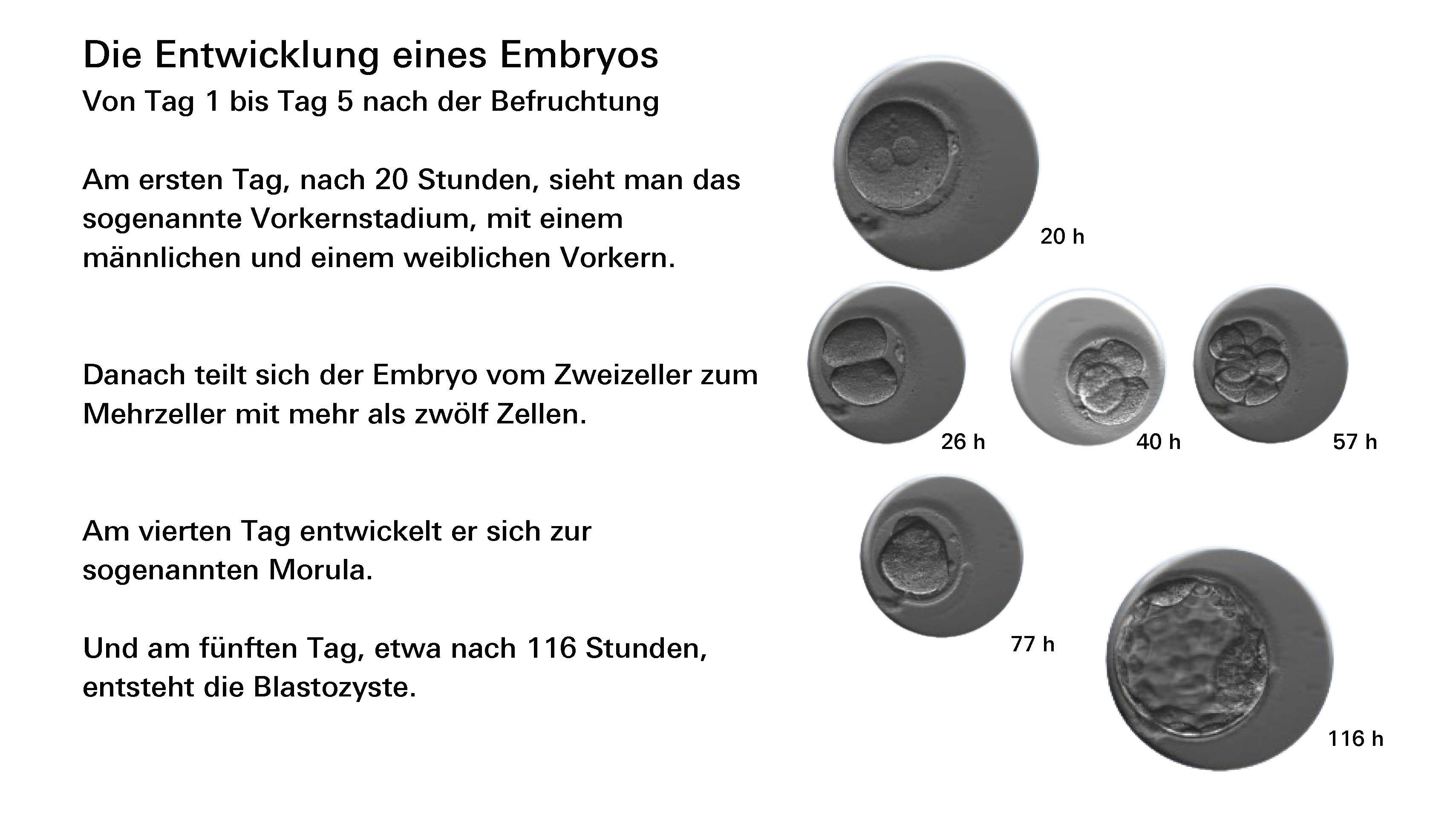 Die Entwicklung eines Embryos von Tag 1 bis Tag 5 nach der Befruchtung: Am ersten Tag, nach 20 Stunden, sieht man das sogenannte Vorkernstadium, mit einem männlichen und einem weiblichen Vorkern. Danach teilt sich der Embryo vom Zweizeller zum Mehrzeller mit mehr als zwölf Zellen. Am vierten Tag entwickelt er sich zur sogenannten Morula. Und am fünften Tag, etwa nach 116 Stunden, entsteht die Blastozyste.