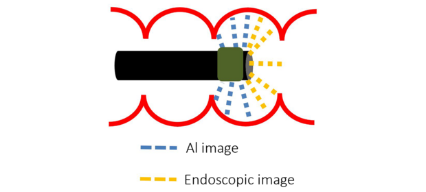 Illustration: An endoscope with embedded micro-optical rear-viewing cameras.