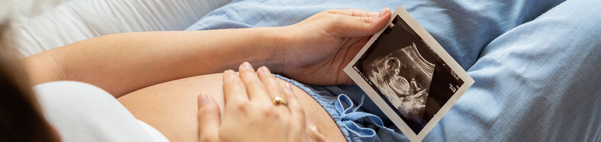 Eine schwangere Person mit nacktem Babybauch hält ein Ultraschall-Bild in der Hand