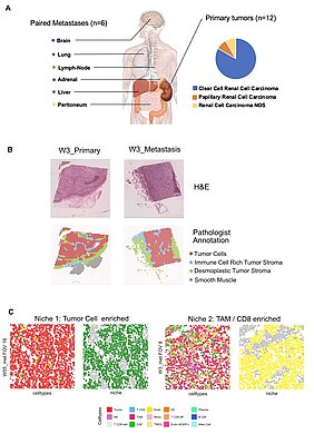 Die Abbildung besteht aus drei Grafiken. Oben ist ein Oberkörper zu sehen mit Hinweisen, wo die Proben entnommen wurden, in der Mitte sind histologische Schnitte von Tumorproben, unten vier Abbildungen von Immunnischen. 