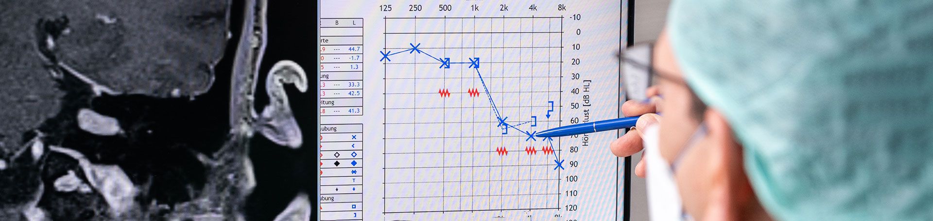 Illustrationsbild: Auswertung eines CTs mithilfe einer Tabelle