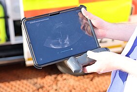 Das neue Gerät unterstützt im Rettungseinsatz dabei, lebensbedrohliche Erkrankungen bereits vor Eintreffen im Krankenhaus schneller und präziser zu erkennen. Die Aufnahmen können direkt am Einsatzort bewertet werden. Das UKW schult sowohl Notärzte als auch Notfallsanitäter gezielt für den Einsatz. Foto: UKW / Kim Sammet