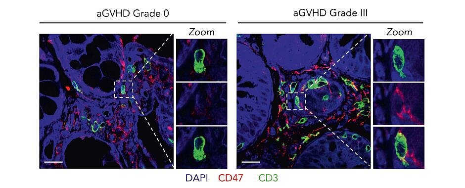 Mikroskopische Aufnahmen von alloreaktiven T-Zellen