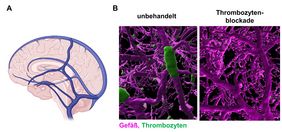 Bild A) zeigt eine schematische Darstellung der großen Hirnvenen. Bild B) zeigt Gefäß, Thrombozyten unbehandelt und eines deren Thrombozyten gehemmt wurde.