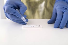 Das Patientenproben-Puffergemisch wird auf den Teststreifen getropft. 