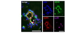 Multikanalfärbung des NLRP3 Inflammasoma