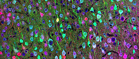 Mikroskopisches Bild zeigt verschiedene Typen von Nervenzellen in mehreren Farben als Lichtpulse an.