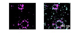 Lichtmikroskopie Munc 13-1 Protein Lattice-SIM zeigt supramolekulare Munc13-1-Cluster in präsynaptischen Membranen an den axonalen Wachstumskegeln kultivierter Motoneuronen. Einfügung auf der rechten Seite: Die Vergrößerung zeigt die Kolokalisierung von Munc13-1 mit Snap25 in supramolekularen Clustern.