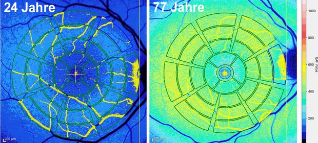 Abbildung einer quantitativen Fundus-Autofluoreszenz QAF