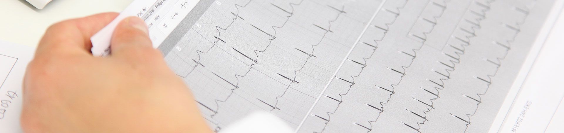 Foto eines Protokolls eines Langzeit EKGs