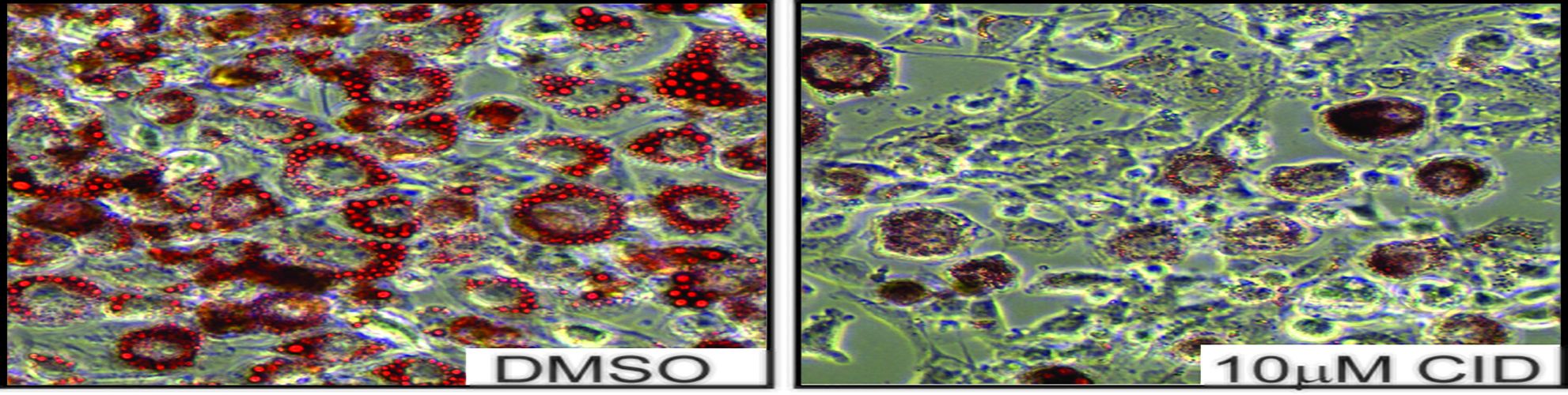 Fettzellen, die während ihrer Differenzierung mit einem PKD-Hemmstoff behandelt wurden (Abbildung rechts), speichern sehr viel weniger Fetttröpfchen (rot) als unbehandelte Zellen (Abbildung links)