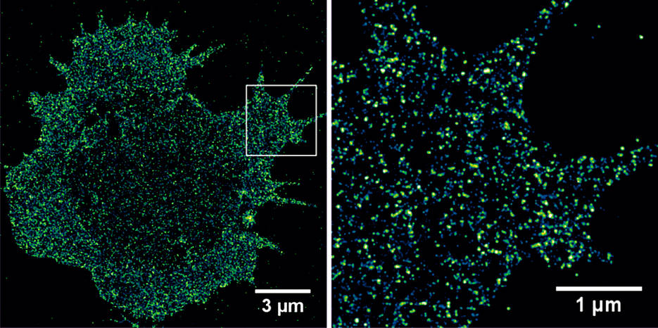 Abbildung über die Verteilung von CD19-Antigenen in der Plasmamembran einer multiplen Myelomzelle aufgenommen mittels dSTORM