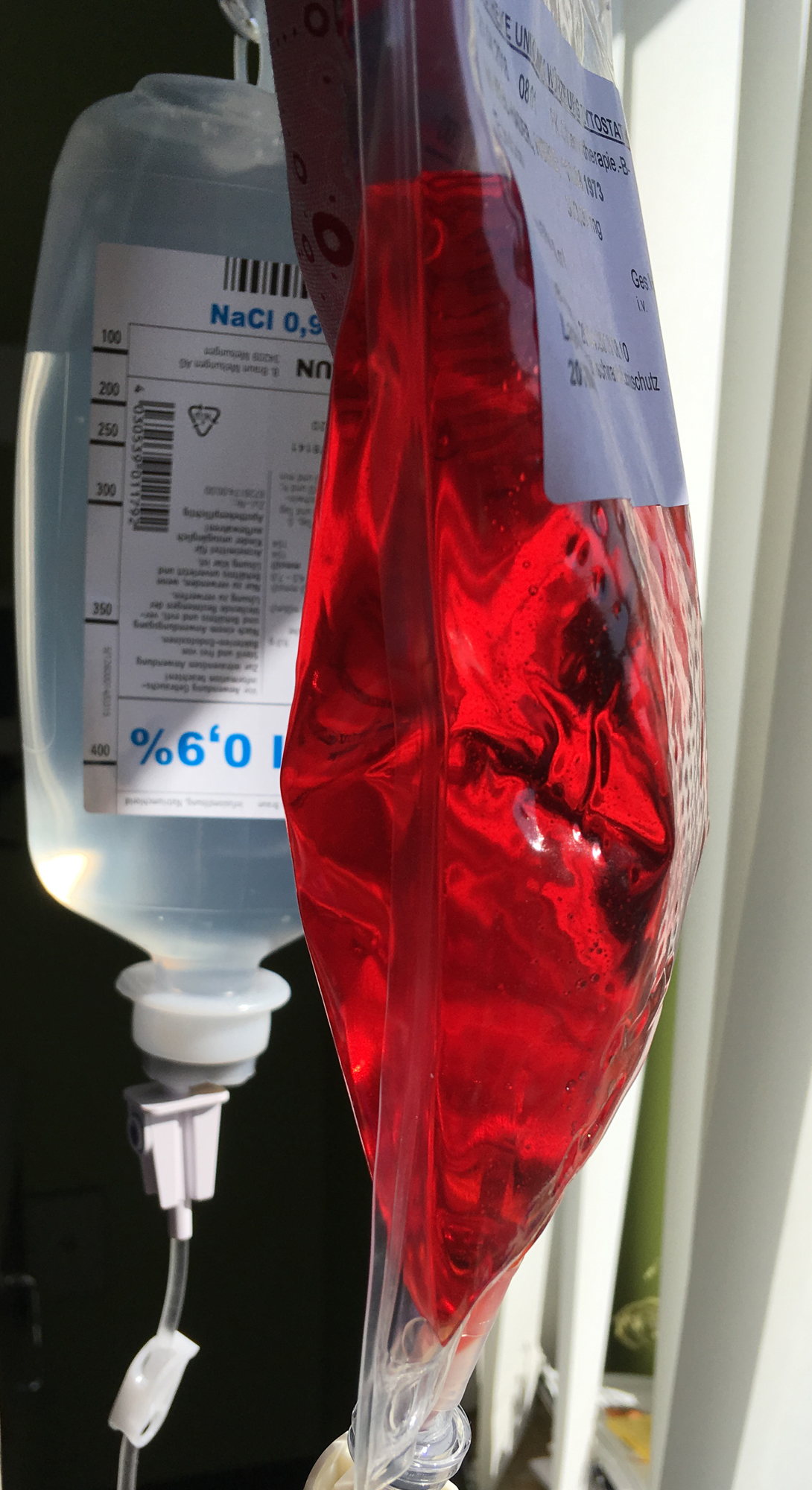 Chemotherapie