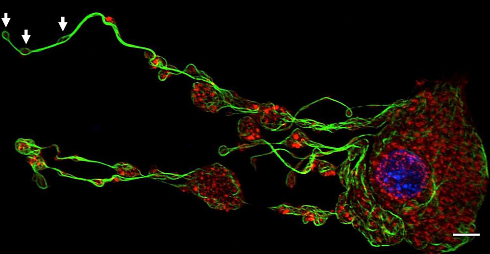 Entstehende Thrombozyten