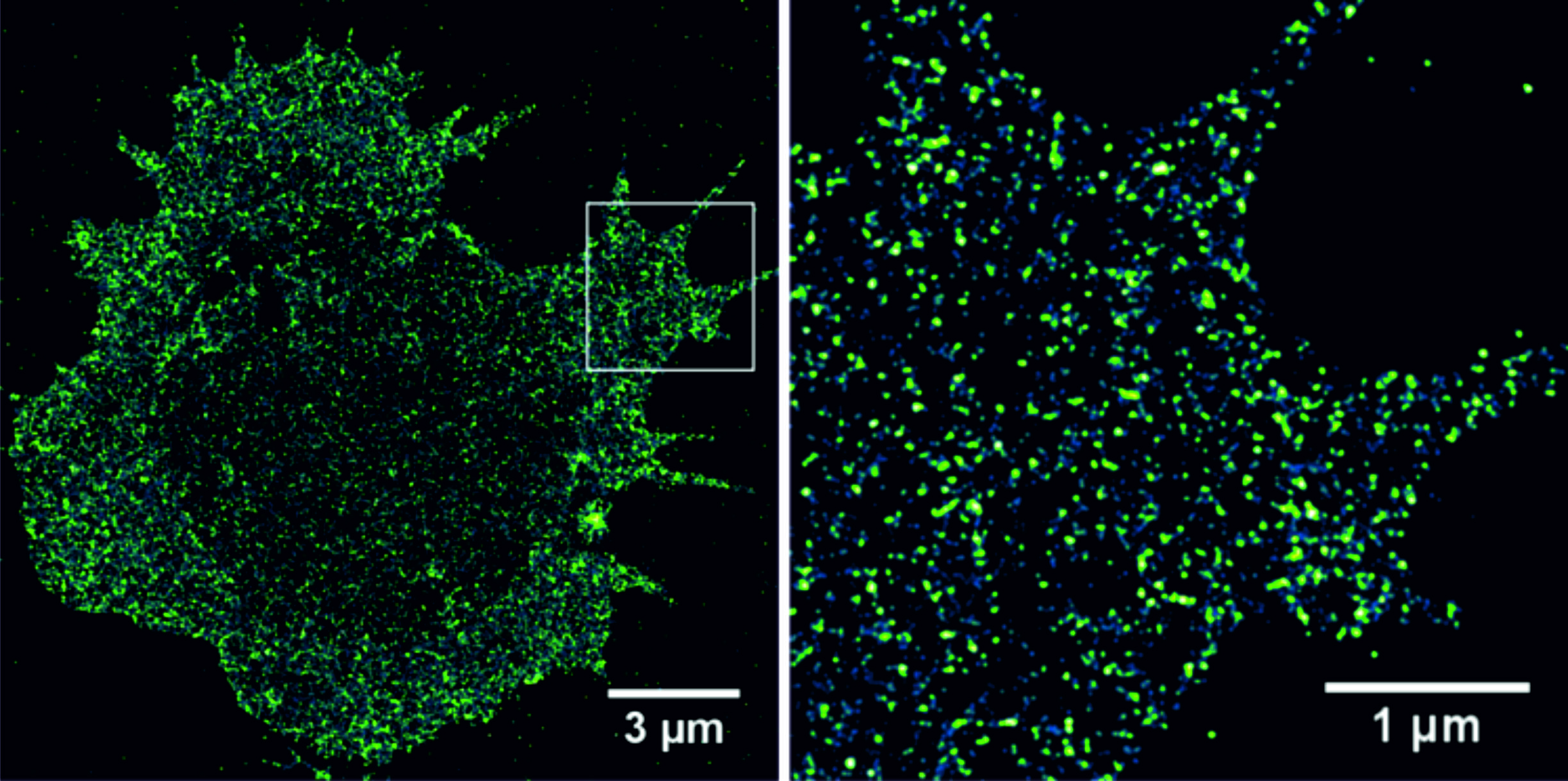 CD19-Antigene in der Plasmamembran einer multiplen Myelomzelle