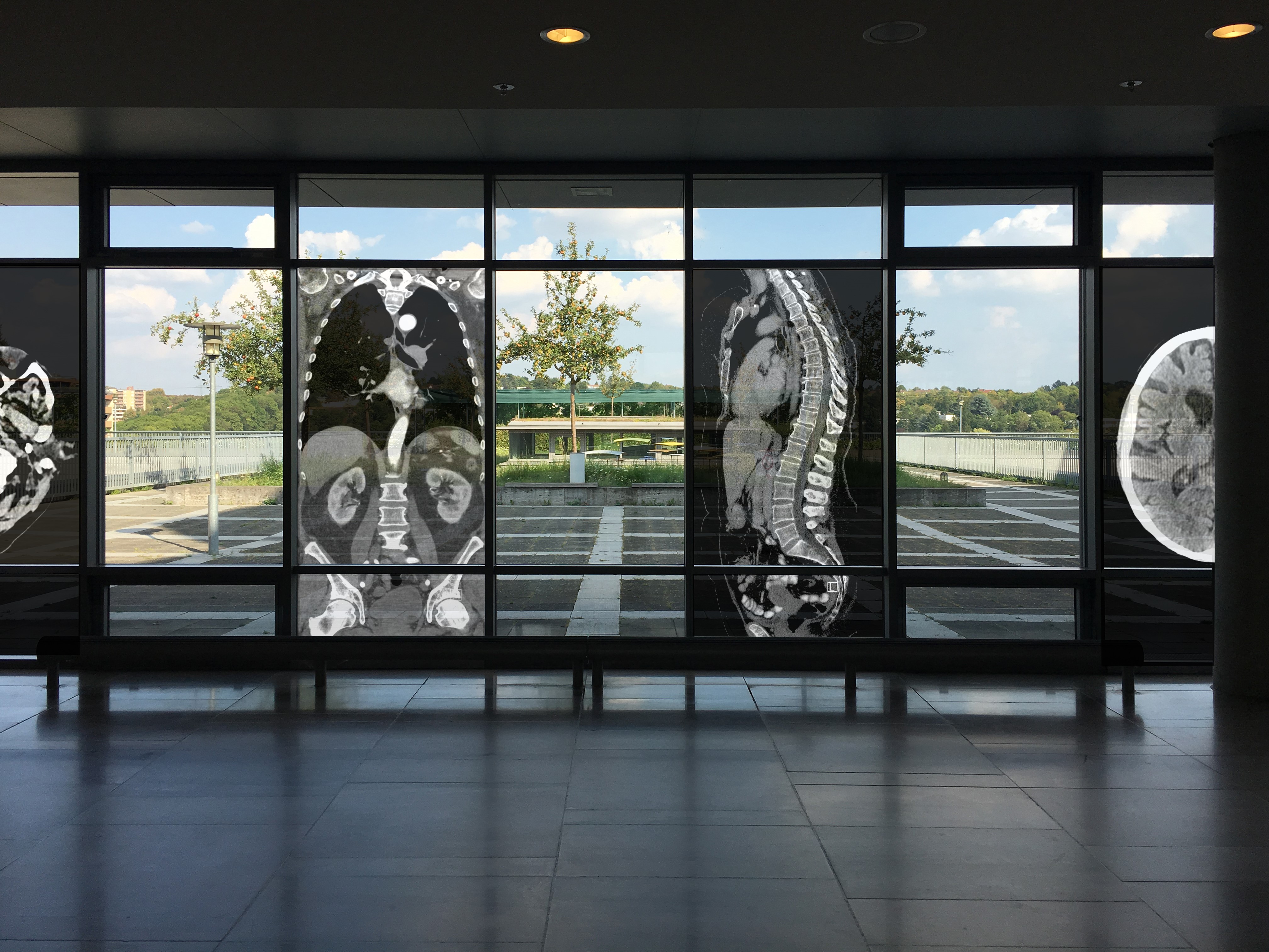 Visauliserung der Fenstergestaltung für die Ausstellung "Spektrum Röntgen"