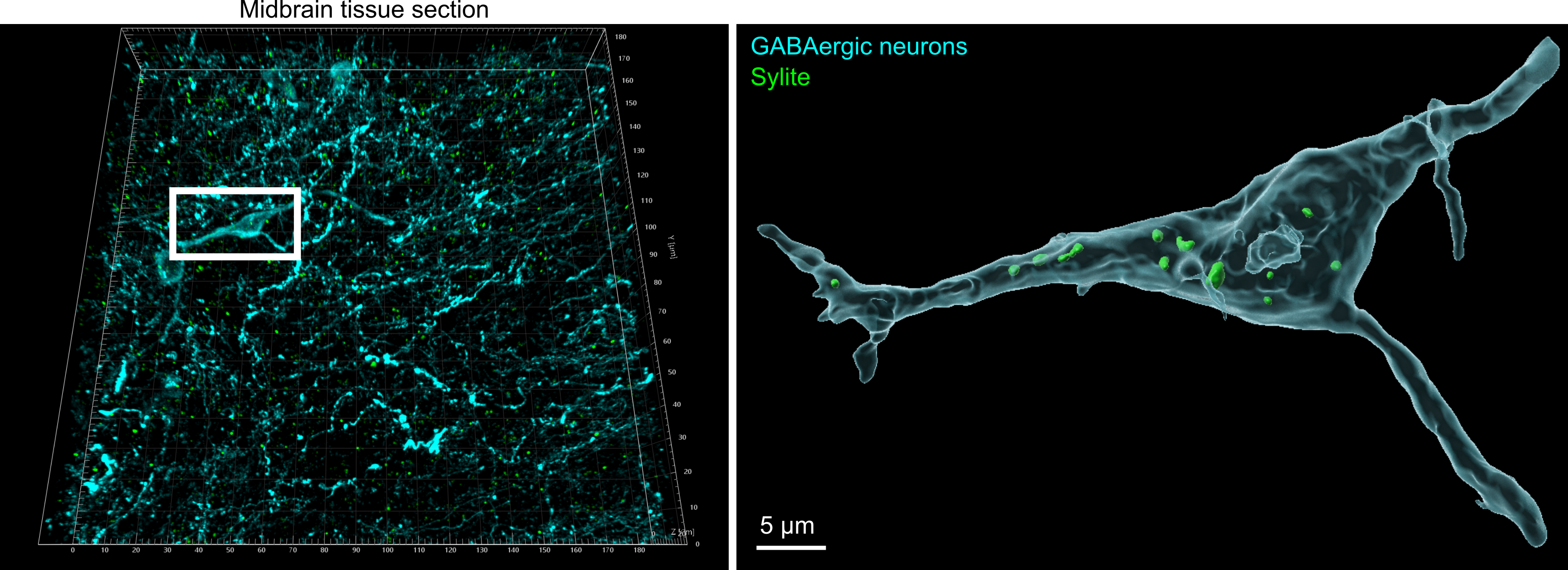 Sylite staining (green) of a periaqueductal gray midbrain section, GABAergic neurons are visualized in light blue. Boxed: 3D volumetric reconstruction of a single GABAergic neuron cell body from the brain section, multiple inhibitory synapses are effectively visualized in the soma after a simple one-step staining protocol. Scale bar 5 μm.