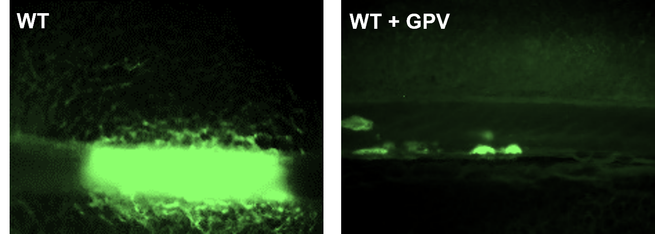 Das Bild zeigt, dass lösliches GPV die Bildung eines Thrombus im Blutgefäß verhindern kann. 