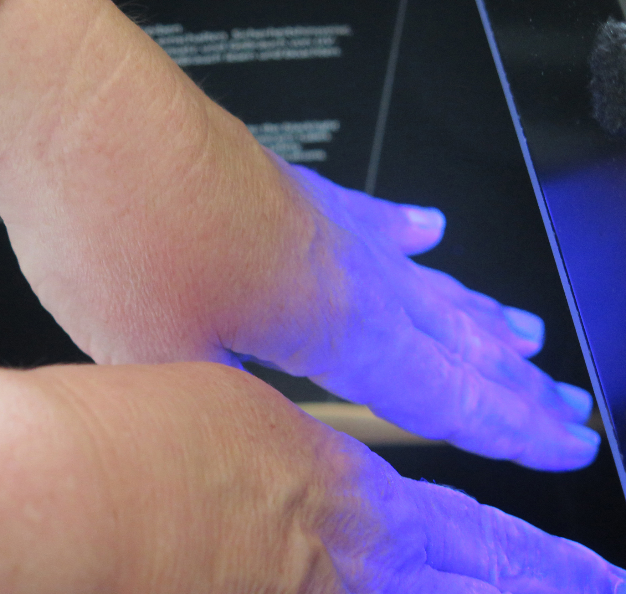 Unter UV-Licht lässt sich kontrollieren, wie effektiv eine Händedesinfektion durchgeführt wurde.
