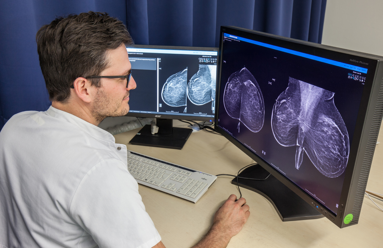 Mitarbeiter sichtet am Computer Mammografie-Bilder