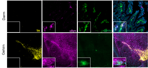 Zellen im Darm und Hirn einer PD Maus 