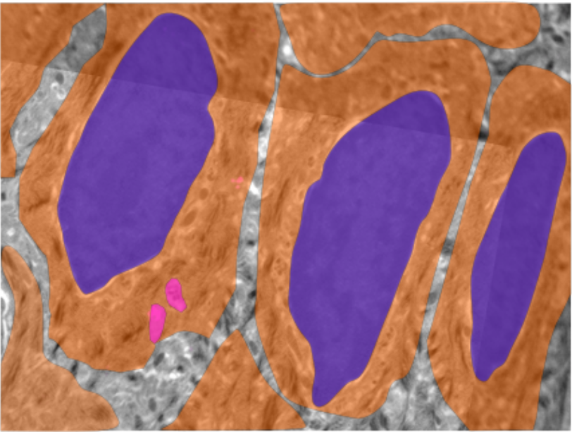 Mikroskopische Aufnahme von Hautzelle und Nervenfaser. 