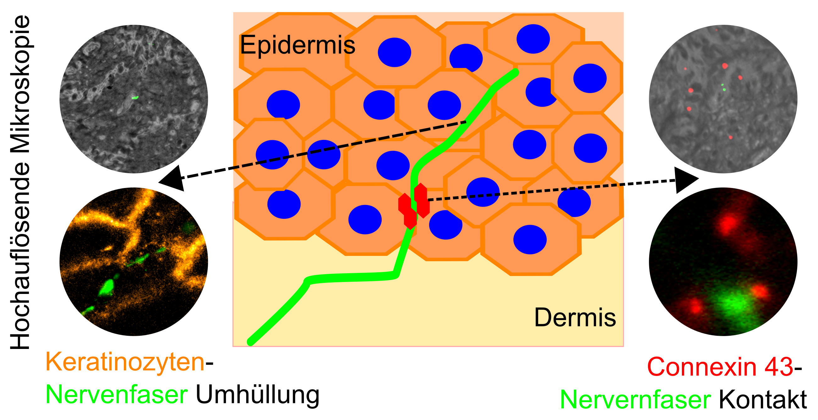 Mikroskopische Bilder der Keratinozyten-Nervenfaser-Umhüllung und Connexin-43-Nervenfaser-Kontakt 