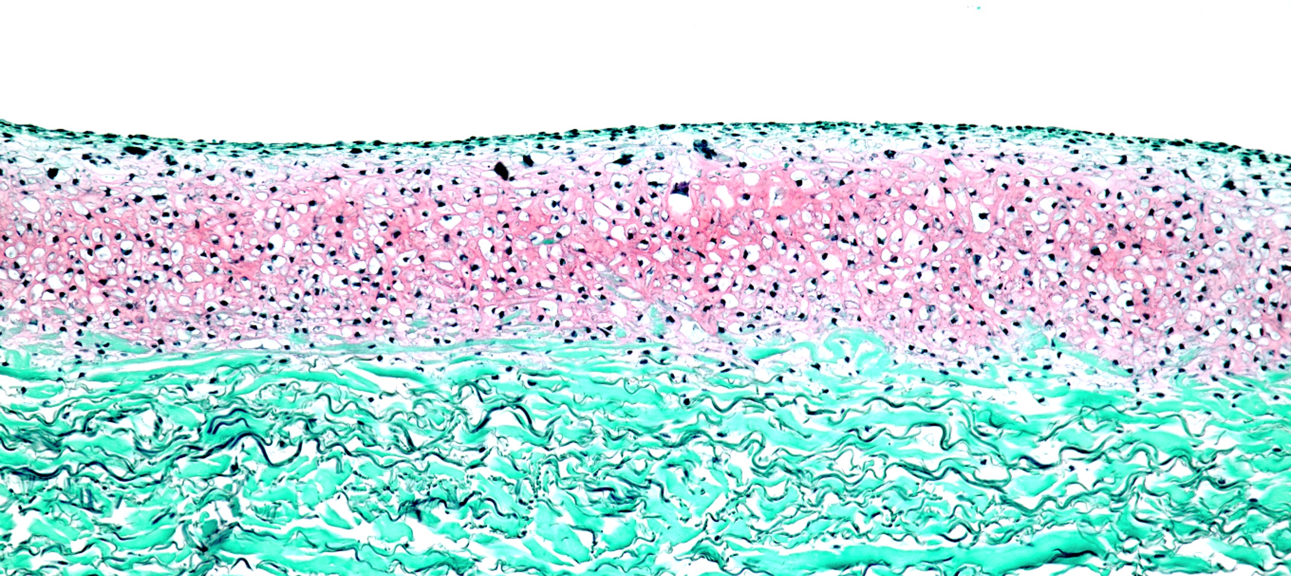 Histologische Färbung der Knorpelschicht 