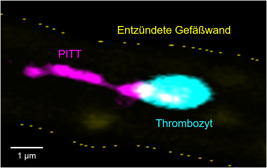 Mikroskopische Aufnahme vom Blutplättchen und der abgespaltenen Organelle 