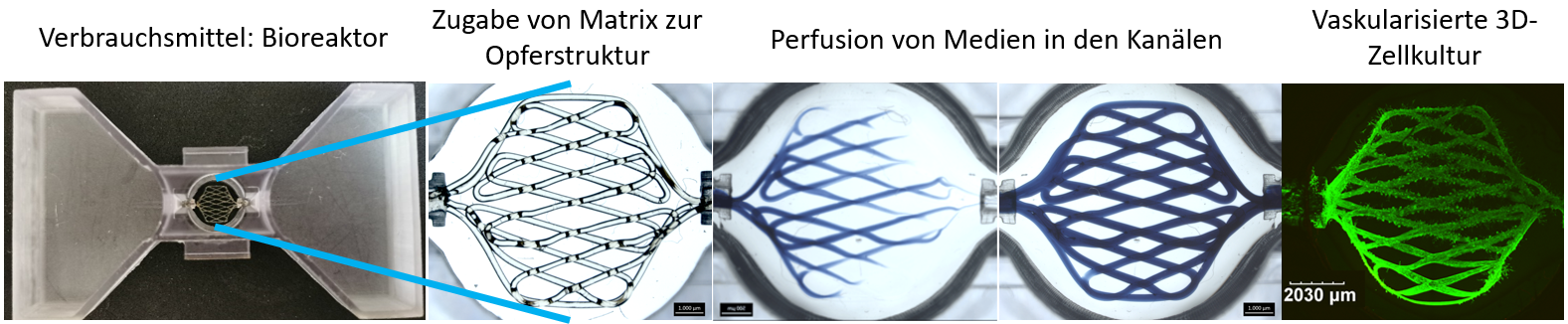 Grafische Abbildung der Vasc-on-Demand-Technologie