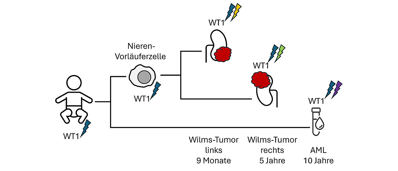 Bei einem Kind mit einer genetischen Veranlagung zum Wilms-Tumor trugen alle Körperzellen bereits eine mutierte Kopie des WT1-Gens. 
