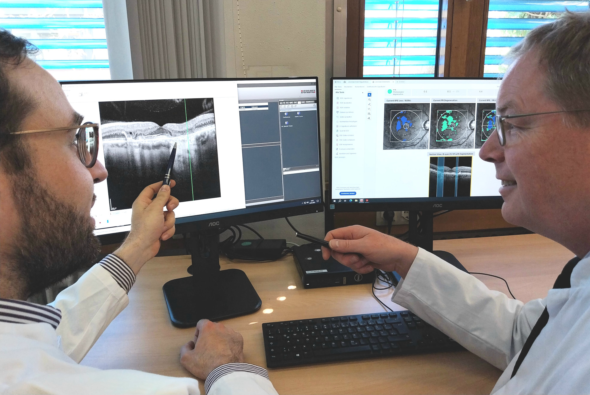 Dr. Andreas Berlin (links) und Prof. Dr. Jost Hillenkamp von der Würzburger Universitäts-Augenklinik diskutieren die vom Programm Fluid Monitor (linker Bildschirm) angebotenen Diagnose-Informationen zur feuchten altersbedingten Makuladegeneration.  Regina Vornberger / UKW