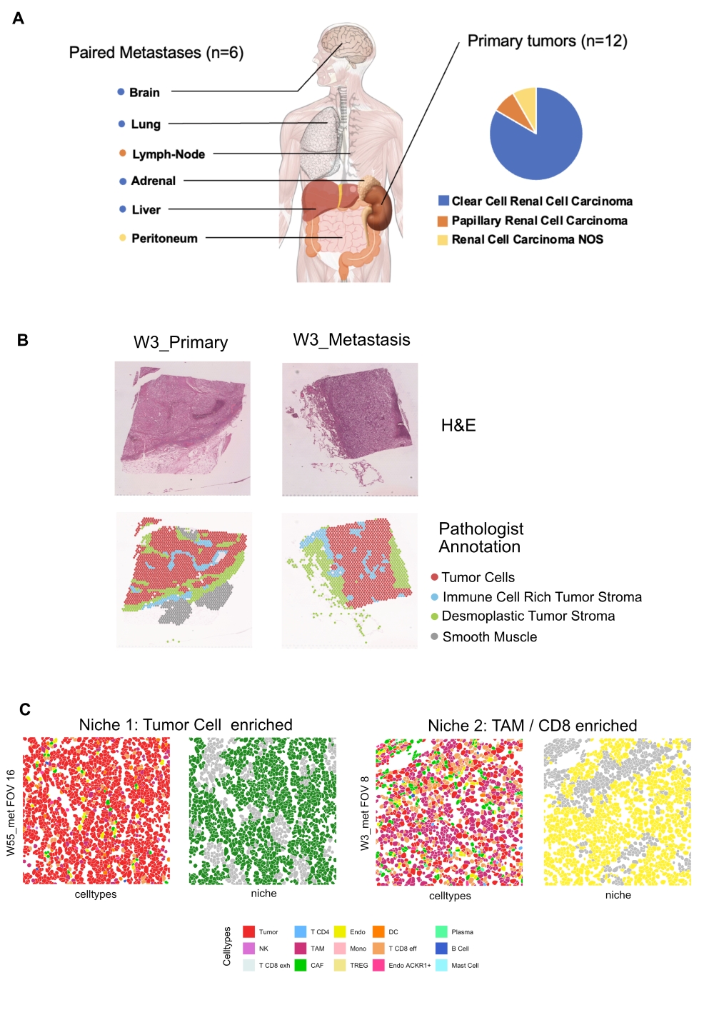 Figure mRCC Die Abbildung besteht aus drei Grafiken. Oben ist ein Oberkörper zu sehen mit Hinweisen, wo die Proben entnommen wurden, in der Mitte sind histologische Schnitte von Tumorproben, unten vier Abbildungen von Immunnischen.